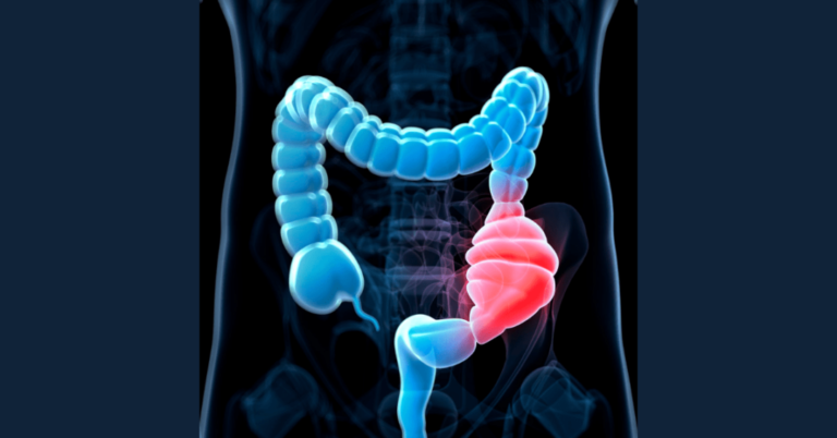 can probiotics cause constipation