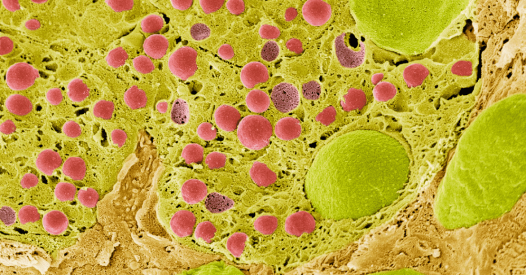 digestive enzymes vs probiotics 2